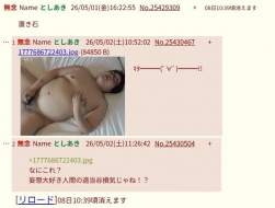 70965 B