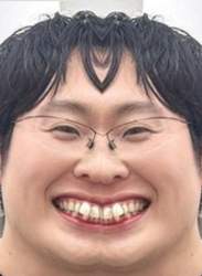 39606 B