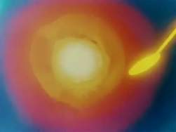 5409425 B