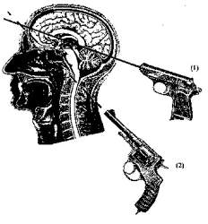 44306 B