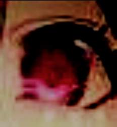 611176 B