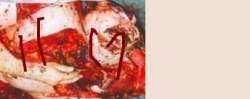70661 B