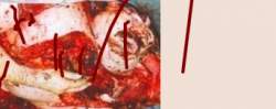 71434 B