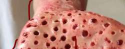86557 B