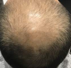 1216656 B