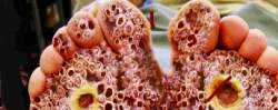 120412 B