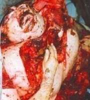 87261 B